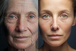 The photo on the left depicts her face extreme wrinkles while the photo on the right reveals a significant glowing skin.