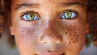 child with freckles