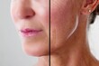 © Andrey Popov - Before and after therapy: Woman's face lift
