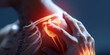 Visualizing Knee Pain Illustrating Injury and Anatomy