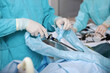 Laparoscopic instruments in the hands of a surgeon. Laparoscopic surgery. Surgery through small holes in the abdominal cavity. Modern surgery.