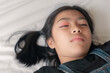 Asian girl has swollen eyes shell, her lay on the bed.