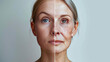 © Mehran - The picture shows a woman's face at different ages. On the left, she is young and her skin is clear. On the right, she is older and her skin has wrinkles. This shows the process of aging.
