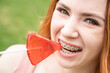Beautiful young woman with braces on her teeth eats a watermelon-shaped lollipop outdoors. 
