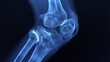 X-ray of the knee joint on black