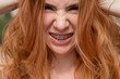Close-up portrait of a young red-haired woman with braces on her teeth. Girl makes faces at the camera outdoors. 