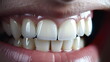 Close-up of human teeth smiling