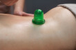 A woman undergoes an anti-cellulite massage procedure using a vacuum jar. Close-up of the lower back. 