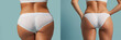 © tanya78 - Thigh a woman in panties before and after weight loss