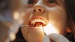 © Parinwat Studio - Extreme closeup of a pediatric dentist treating early childhood caries