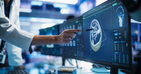 Poster - Modern Cancer Research Medical Center: Anonymous Doctor Pointing At Desktop Computer Monitor With 3D Software Visualizing Human Brain Based On CT Scan. Neurologist Looking For Tumor In Patient's Brain