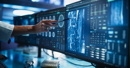 Poster - Modern Cancer Research Medical Center: Anonymous Doctor Pointing At Desktop Computer Monitor With 3D Software Visualizing Human Brain Based On CT Scan. Neurologist Looking For Tumor In Patient's Brain
