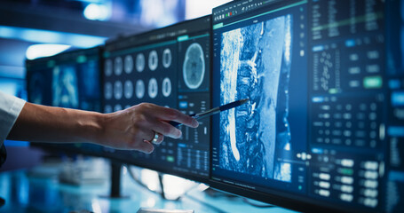 Aufkleber - Modern Medical Research Center: Anonymous Doctor Pointing At Desktop Computer Monitor With Software Visualizing Human Brain Based On MRI Scan. Neurologist Looking For Impacted Areas By Brain Damage.