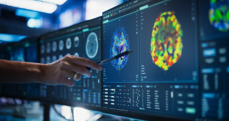 Aufkleber - Modern Medical Research Center: Anonymous Doctor Pointing At Desktop Computer Monitor With CT Scan Of Patient's Spinal Cord. Specialist Looking For Tumors Or Damage, Looking For Treatment Methods.