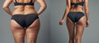 © tanya78 - Thigh a woman in panties before and after weight loss
