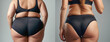 © tanya78 - Thigh a woman in panties before and after weight loss