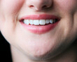 Macro Studio Expression Shot Of Woman's Mouth With Close Up On Lips And Teeth