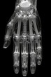 artificial hand as part of a medical prosthesis or robot cyborg hand