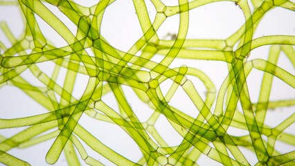 The water net (Hydrodictyon sp) under microscope. Collected from paddy fields in Indonesia. Stacked photo