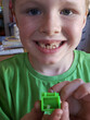 Joyful boy with freckles shows off toothless grin and lost tooth