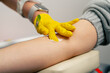 © Guys Who Shoot - close-up in the clinic doctor in yellow gloves takes blood for tests from a patient