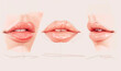 Cosmetic surgery lip reshaping