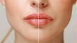© Mehran - Before treatment, the person's lips were chapped, cracked, and dry. After treatment, their lips are healthy and smooth.