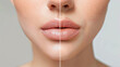 © Mehran - Before treatment, the person's lips were chapped, cracked, and dry. After treatment, their lips are healthy and smooth.