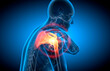 Man with painful shoulder joint with blue background - x-ray 3d illustration