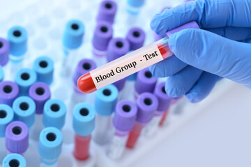 Wall Mural - Doctor holding a test blood sample tube with Blood Group test on the background of medical test tubes with analyzes.