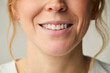 Studio Shot Of Woman Smiling Against Plain Background With Close Up On Lips And Teeth