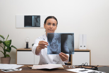 Aufkleber -  female doctor engages in a telemedicine consultation, pointing at an X-ray film while explaining the pathology to the patient online, looking to camera. 