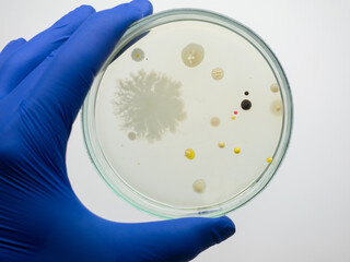 Canvas Print - A petri dish with colonies of bacteria, in the background a working microscope magnifies bacterial cells.