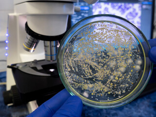 Wall Mural - A petri dish with colonies of yellow bacteria in the hand of a scientist against the background of a working microscope in the laboratory.