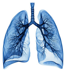 PNG X-ray picture of lungs white background accessories tomography.