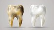 © Яна Деменишина - Comparison of healthy and unhealthy human teeth, illustrating the impact of proper oral hygiene