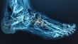 X-ray of feet showing the complex structure of bones and joints, used in podiatry and sports medicine.