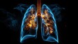 X-ray of human lungs affected by pneumonia, highlighting medical conditions and respiratory care.