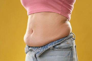 Poster - Woman with excessive belly fat on goldenrod background, closeup. Overweight problem