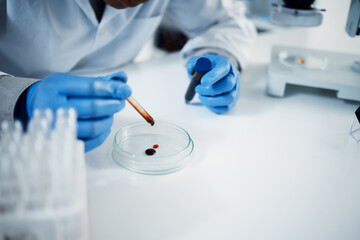 Poster - Scientist, hands and blood with petri dish for test in lab with sample for dna or forensic biology. Microbiologist, science and innovation for vaccine or person with gloves for chemistry career.
