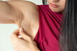 Armpit chicken skin, wrinkle and uneven underarm fatty cellulite chicken skin, woman hand holding annoying chicken skin of woman with extra body derma fat, female body and skin care concept image