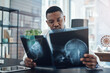 © peopleimages.com - Healthcare, black man and surgeon with xray for diagnosis, check results or ideas in hospital. Neurology, review and doctor with brain scan for assessment, bone cancer or planning treatment on tumor