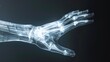 a painful hand in x-ray