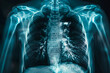 © lashkhidzetim - A close up of a person's chest with a blue hue. The image is of a person's chest and lungs, and it is a medical image. The blue color gives the image a calm and soothing mood