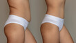 Two shots of a woman in a white underwear with a fat belly and toned slim abdomen before and after losing weight on gray background. Result of diet, liposuction, training. Getting rid of overweight