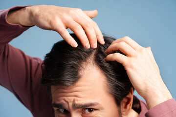 Wall Mural - Close up of man examining his head on light blue background. Health care, medicine concept