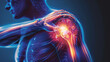 X-Ray Imaging shoulder pain on the shoulder area