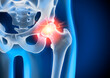 Medical 3D illustration in X-ray style of a painful hip joint with blue background