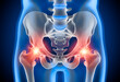 Medical 3D illustration in X-ray style of a painful hip joint with blue background