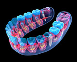 Fototapeta Tęcza - Visual Representation of Oral Health , Bacteria Attack on Teeth
